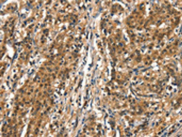 DDX4 Antibody (PACO19550)