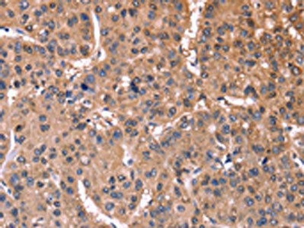 ETFB Antibody (PACO19625)