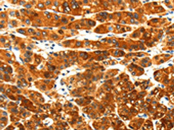 PLXNA3 Antibody (PACO20247)