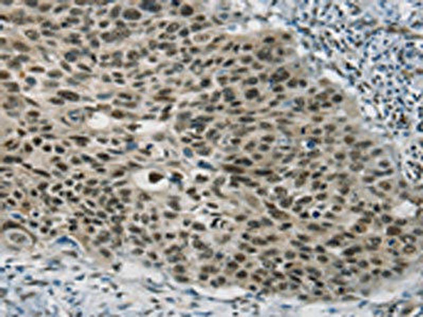 SART3 Antibody (PACO20393)