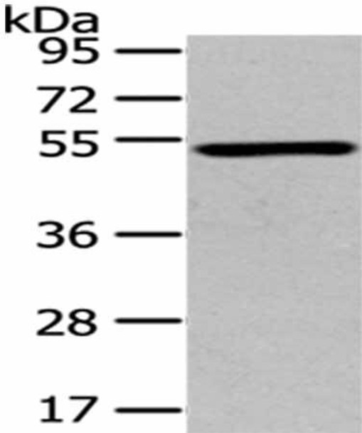 TSPYL1 Antibody (PACO20777)