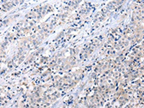 ATF6 Antibody (PACO20991)