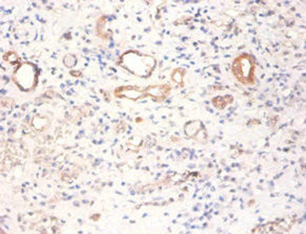 PKM Antibody (PACO31584)