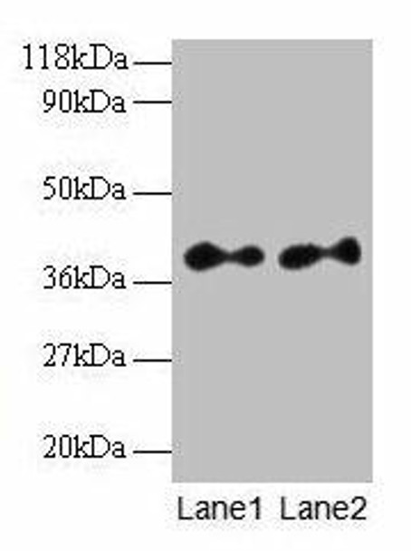 SCAMP3 Antibody (PACO31928)