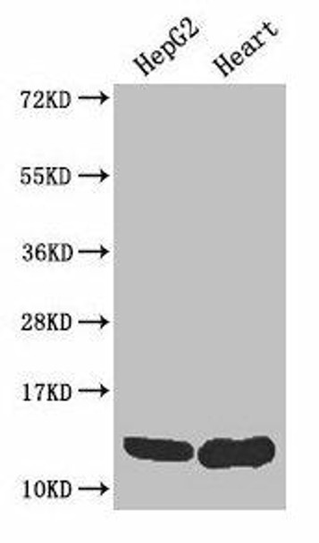 WFDC2 Antibody (PACO32756)