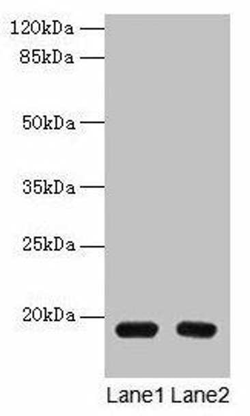 PDE6D Antibody (PACO35138)