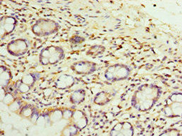 SULT1E1 Antibody (PACO43669)