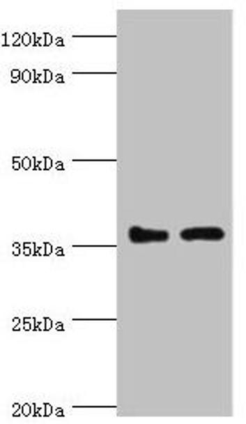 BRCC3 Antibody (PACO43688)