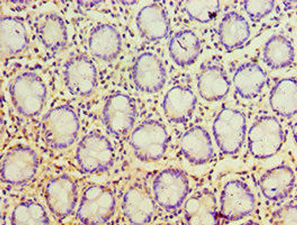 PSCA Antibody (PACO43757)