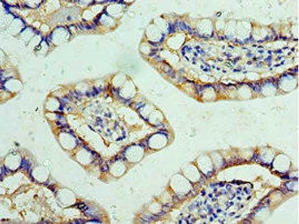 FBXW4 Antibody (PACO43797)