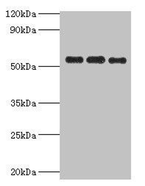 PDHX Antibody (PACO43825)