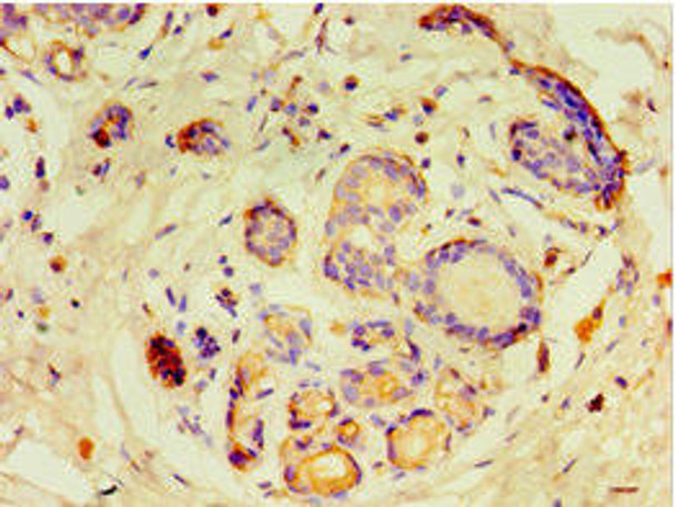 GTF2H2C Antibody (PACO43869)