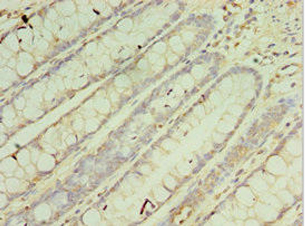 CRADD Antibody (PACO43920)