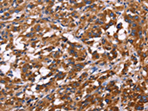 KIR2DL3/KIR2DL1/KIR2DL4/KIR2DS4 Antibody (PACO15953)