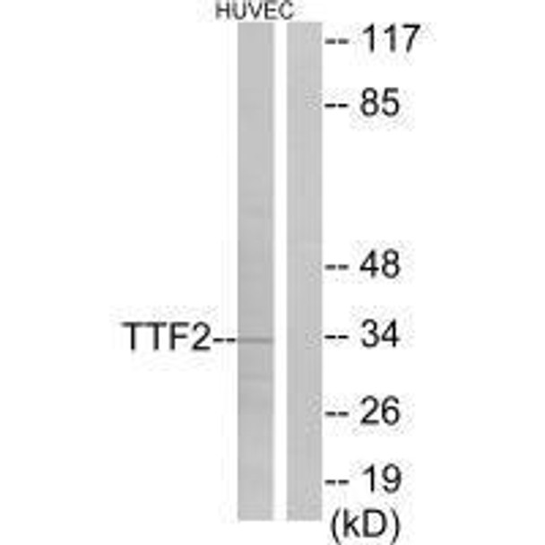 FOXE1 Antibody (PACO21676)