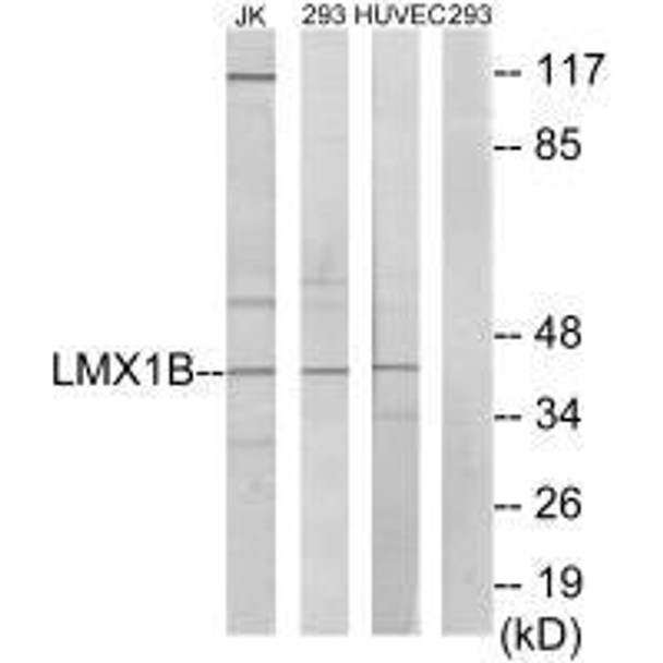 LMX1B Antibody (PACO21694)