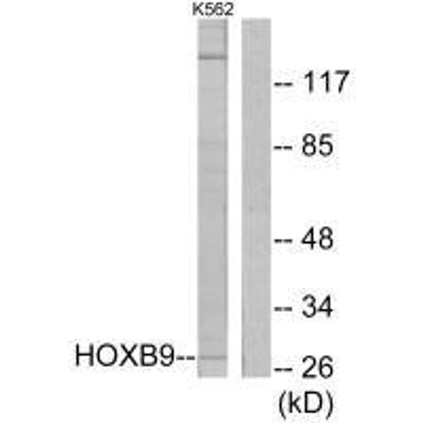 HOXB9 Antibody (PACO21738)