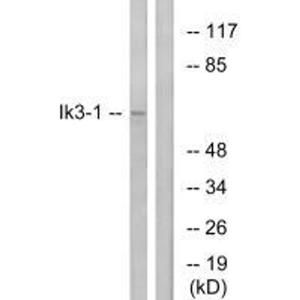CABLES1 Antibody (PACO22016)