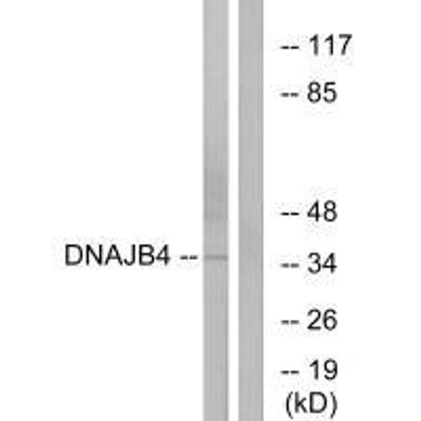 DNAJB4 Antibody (PACO22052)