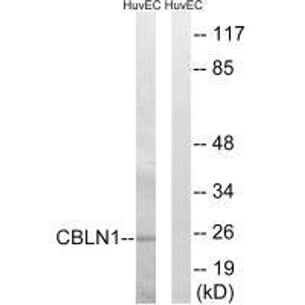 CBLN1 Antibody (PACO22256)