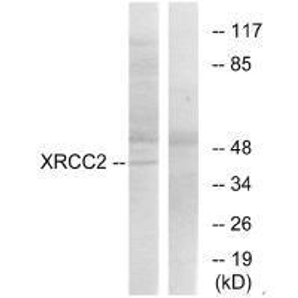 XRCC2 Antibody (PACO23156)