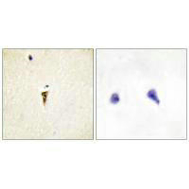 ICK Antibody (PACO23295)