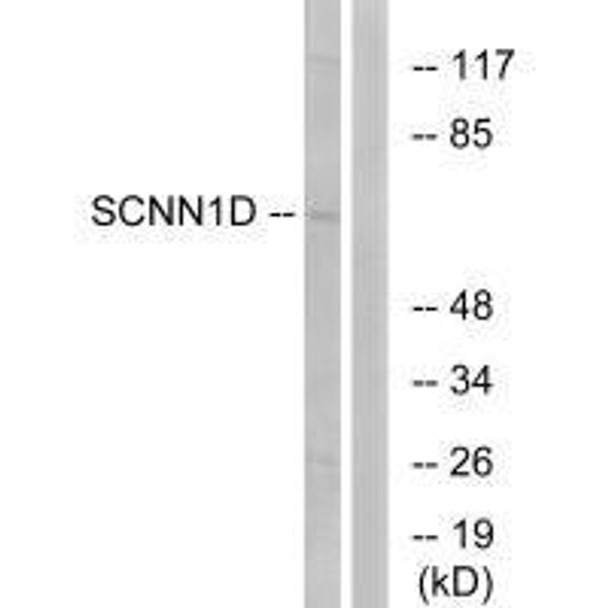 SCNN1D Antibody (PACO23378)