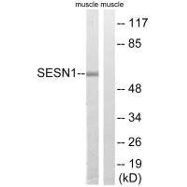 SESN1 Antibody (PACO23481)