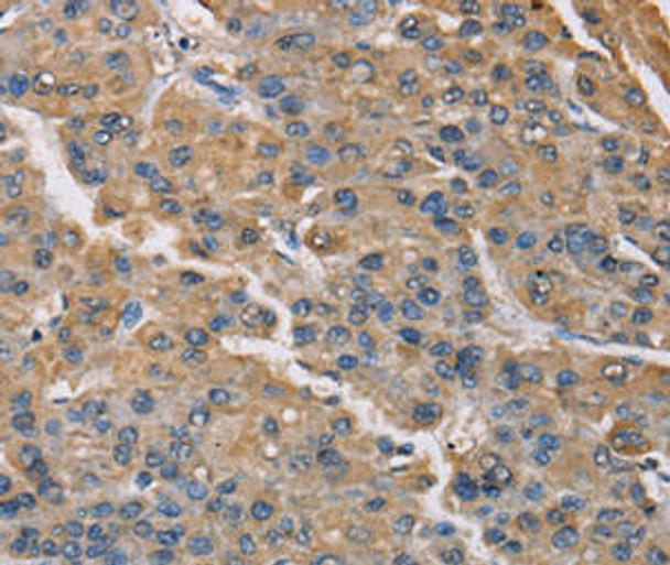 PMAIP1 Antibody (PACO23518)