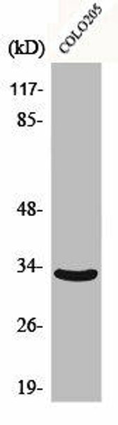 CNR2 Antibody (PACO00531)