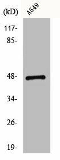 CCKBR Antibody (PACO00541)