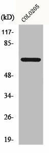 FOXO4 Antibody (PACO00821)