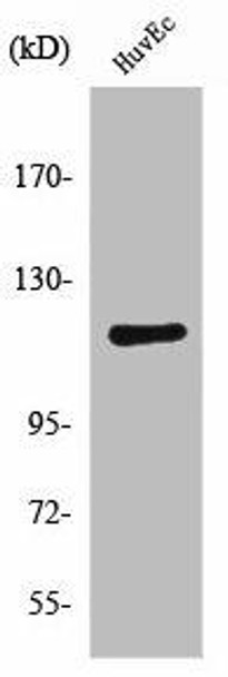 PRKD1 Antibody (PACO01346)