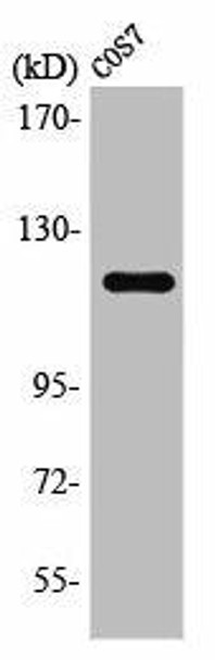 PTK2B Antibody (PACO01381)