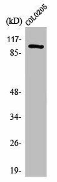 SNCAIP Antibody (PACO01566)