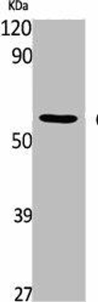 CAMK2D Antibody (PACO01782)