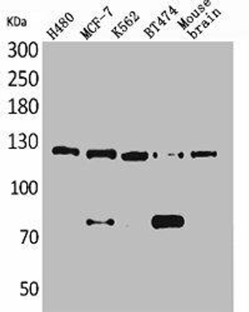 NCAM1 Antibody (PACO01860)