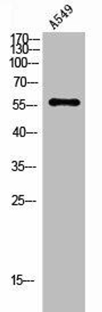 ANGPT1 Antibody (PACO02053)