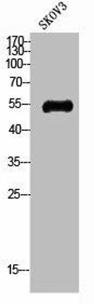 SLC2A4 Antibody (PACO02191)