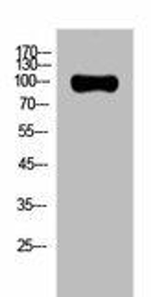 AR Antibody (PACO02204)