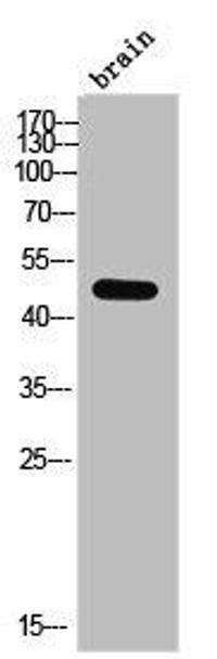 CSNK1D Antibody (PACO02493)