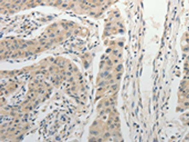 ADHFE1 Antibody (PACO18521)