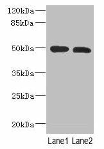 RGMA Antibody (PACO38418)