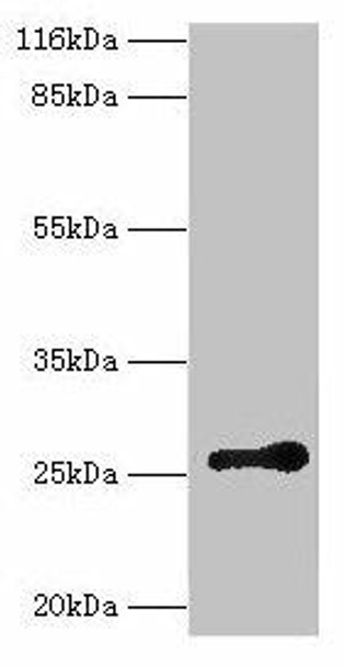 RAB3C Antibody (PACO39294)