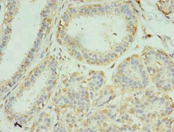 SCAMP4 Antibody (PACO40066)