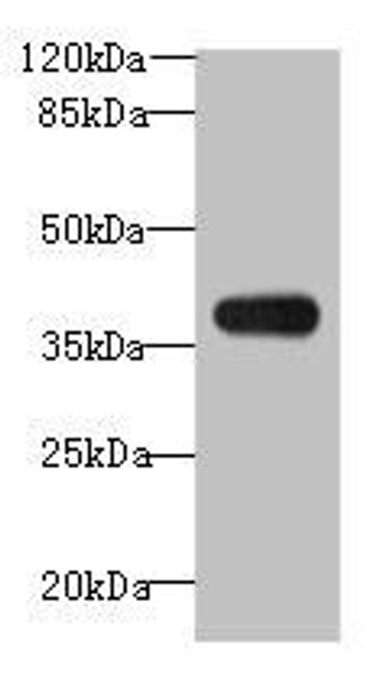 ASB7 Antibody (PACO40574)