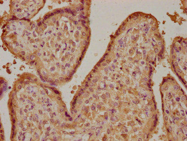 GH1 Antibody (PACO62907)