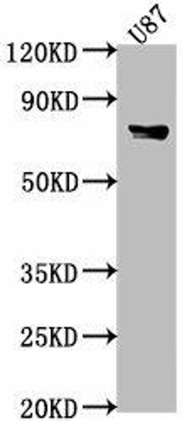 FEM1B Antibody (PACO63515)