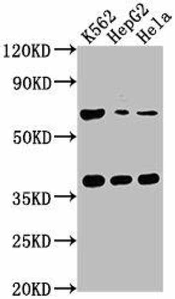 CFHR5 Antibody (PACO63911)