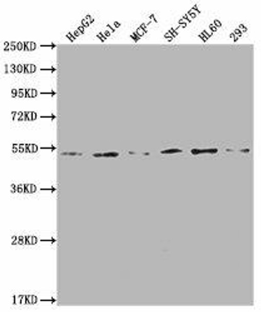 PPARA Antibody (PACO64059)